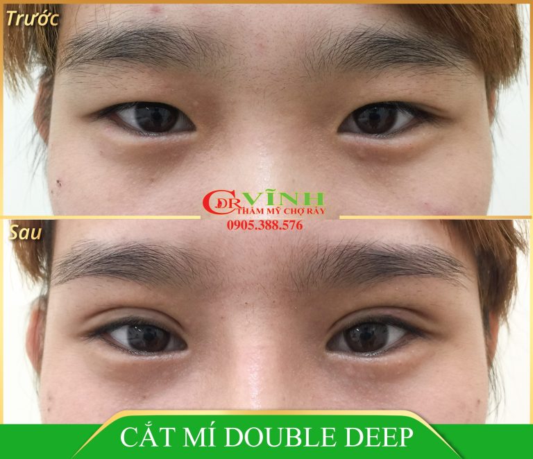 CAT-MAT-DOUBLE-DEEP-1-scaled-1.jpg