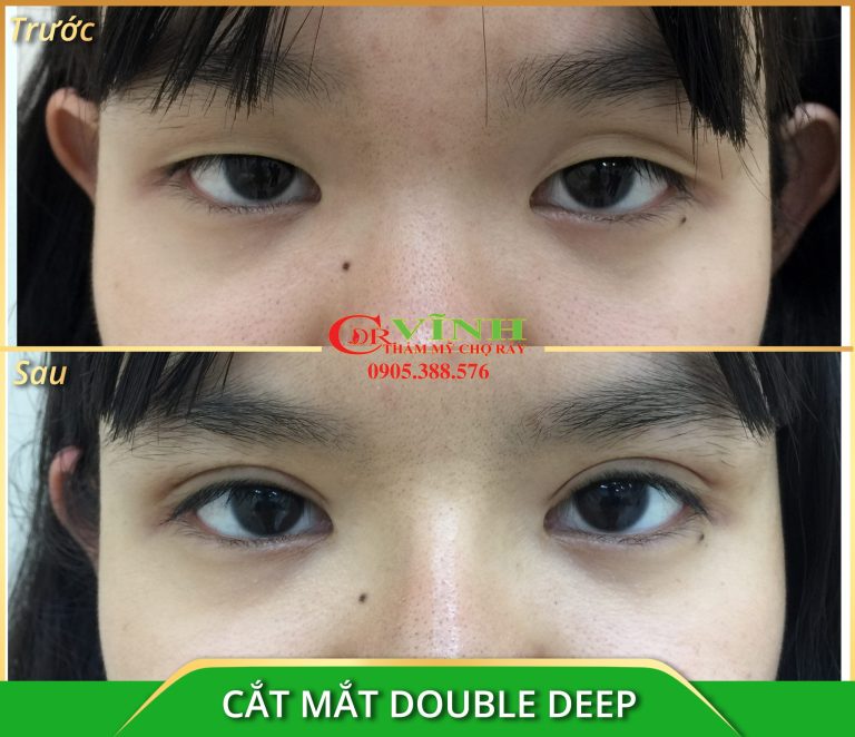 cat-mat-double-deep-Copy2-scaled-1.jpg